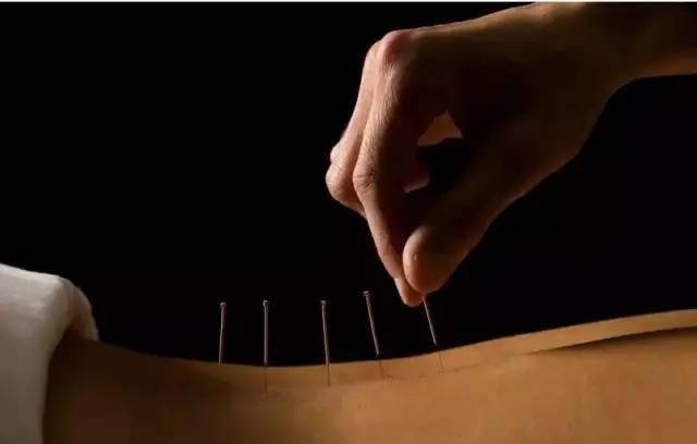 平衡針灸最新視頻，現代應用探索針灸藝術(shù)的新境界