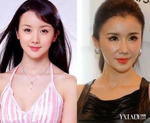 探秘明星整容的秘密，神秘美容小店的魅力所在！